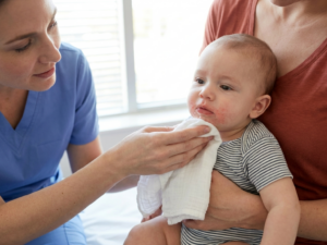 Teething rash around mouth